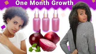Onion Juice For Hair Growth 😱BEFORE AND AFTER RESULTS