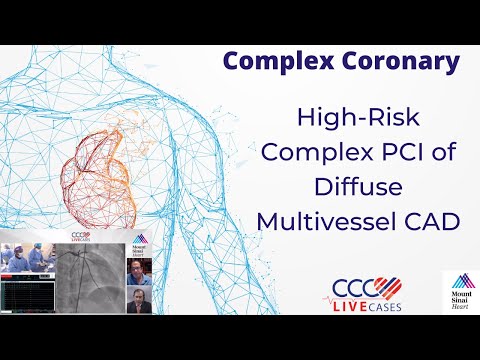 High-Risk Complex PCI of Diffuse Multivessel CAD
