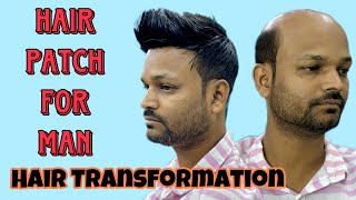 Hair Patch For Men | Hair Patch Center In India | Hair Stylish In Patch |