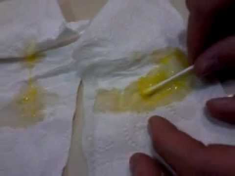 Yellow Snot - Sinus Infection