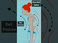 Exercise For Rounded Upper Back Spine Hunch Back Improve Your Posture