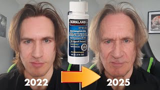 Does Minoxidil cause skin aging