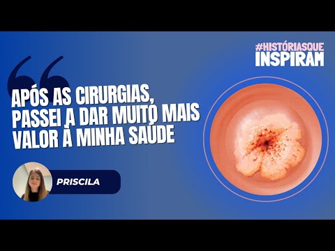 Thumbnail do vídeo