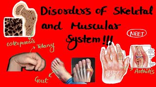All Disorders of muscular and skeletal system . class 11 locomotion and movement .#neet