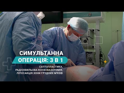 Септопластика и конховазотомия - видео