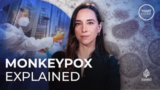 What is monkeypox and should we be worried? | Start Here