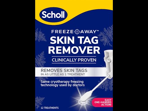 NEW Scholl Freeze Away Skin Tag Remover, effectively removes skin tags in as little as 1 treatment!