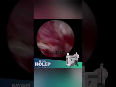 Prof. Dr. Abdullah Demirtaş Video