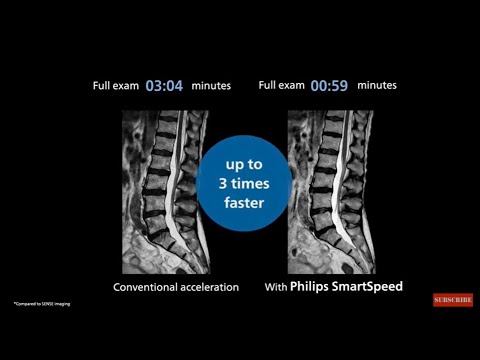 Philips SmartSpeed. No Compromise. Image quality and speed at your fingertips.