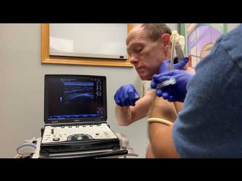 Scapula Pain Injection