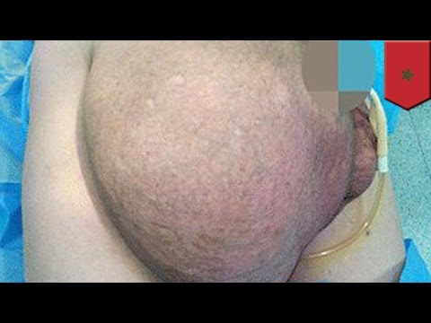 Ano ang pagsasanay ay makakatulong sa mangayayat epektibo Pagbaba ng timbang 54 kg