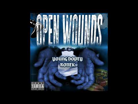 Young Dopey & Ronek - OPEN WOUNDS (Official Audio)