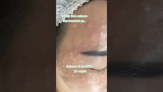 Download lagu Rejuran DNA Salmon mp3