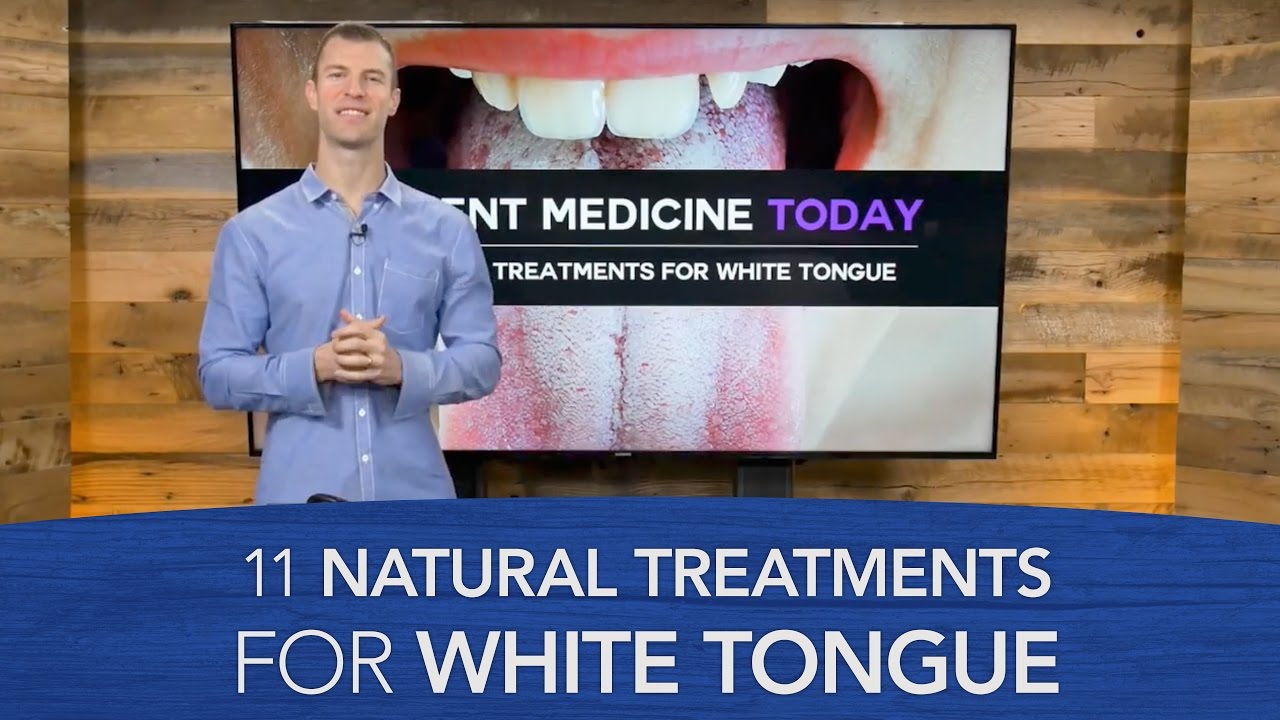 11 Natural Treatments for White Tongue