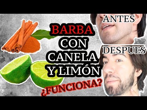 download lagu mp3 mp4 Remedio Casero Para El Crecimiento De Barba, download lagu Remedio Casero Para El Crecimiento De Barba gratis, unduh video klip Remedio Casero Para El Crecimiento De Barba