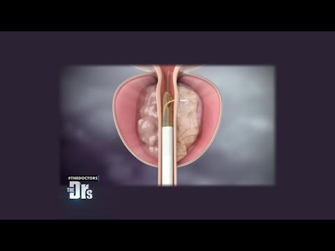 Ein Bluttest für Prostata Ein Bluttest für Prostata-Kosten