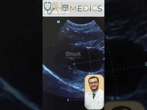 Ahmed Mahmoud-10