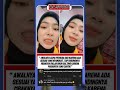 Periksa gigi karena nyangkut sesuai"Cewek cantik ini malah bikin salfok" #shorts #viral #trending