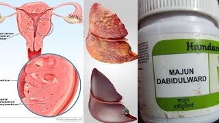 majoon dabeed-ul-ward benefits l माजून दबीदुलवर्द के फायदे l majoon dabeedul ward ke fayde