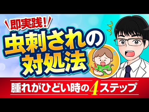 蚊に刺された場合の最良の家庭療法 トピックス