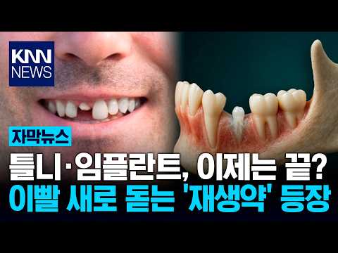 새이빨 나오게 하는 치아 재생 떡밥