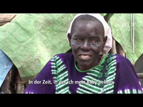 Die allergischen Erkrankungen der Haut. Das Ekzem Die Apotheken wologda von der Schuppenflechte