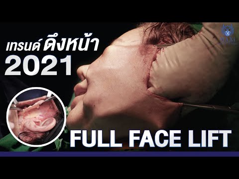 ร้อยไหม หน้าเรียว