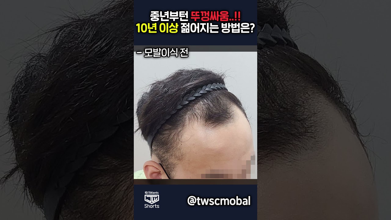 더원츠의원 숏폼