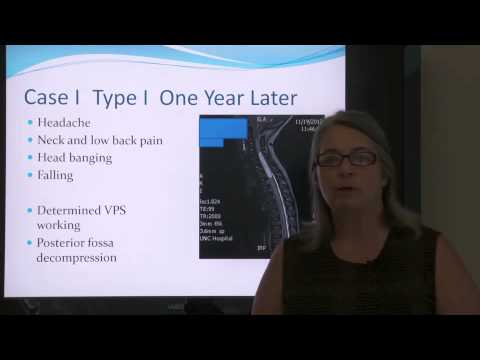CSF presents "Consider Chiari: Chiari Malformation & Syringomyelia" - Gretchen Delametter, CPNP-AC