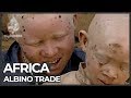 Albino body organs sold for witchcraft