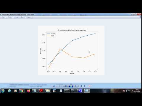 Brain Tumor detection using CNN algorithm