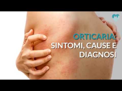 Battuto la testa sul ghiaccio e mal di collo Forte dolore a destra che per alleviare il dolore