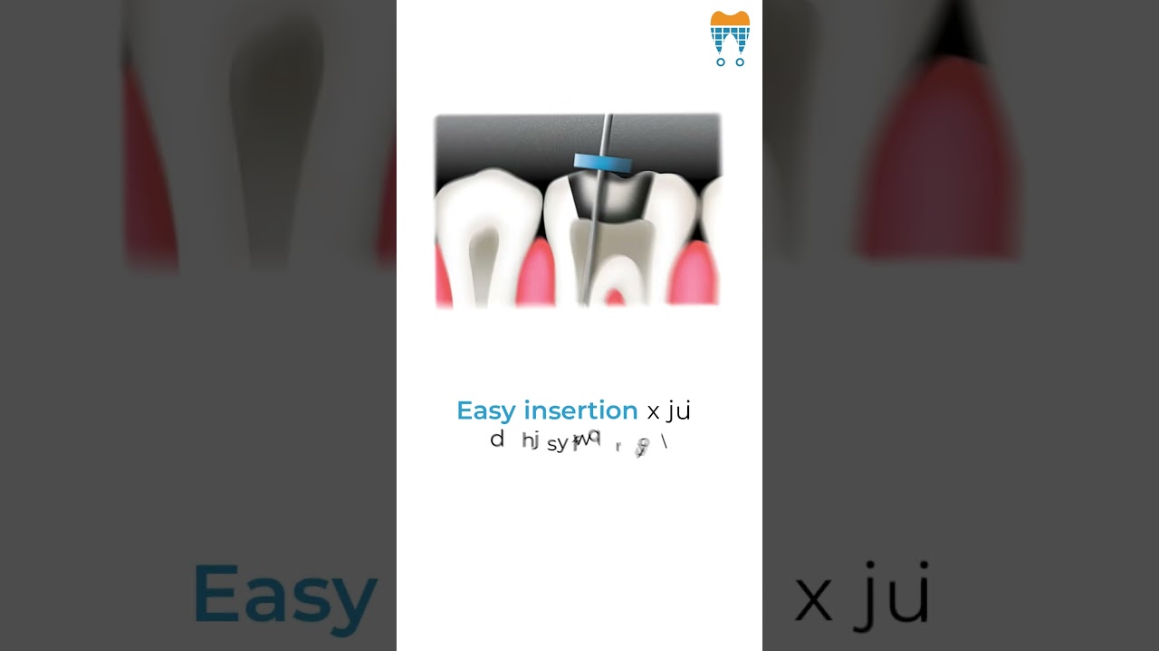 SuperEndo Silicon File Stoppers