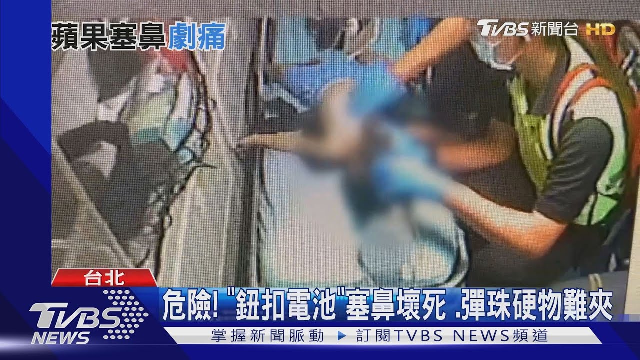 劇痛！男童求診　驚見「0.5公分蘋果」塞鼻腔