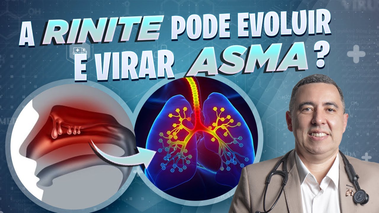Verdade ou mito:  A RINITE pode evoluir para uma ASMA? Médico Pneumologista responde