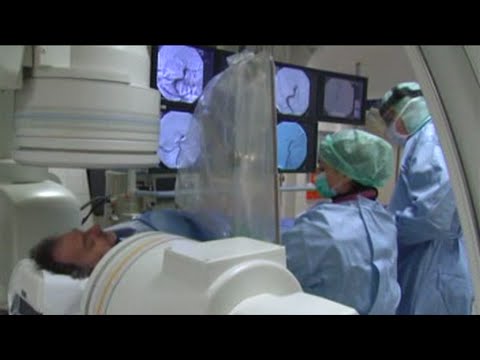 Schlaganfall-Behandlung - so läuft sie bei einem Maximalversorger ab