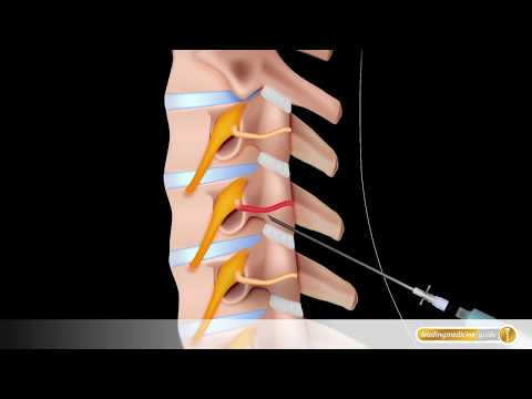 Schmerzen hinter der linken Seite der Rückseite unterhalb der Rippen Hauptturnhalle mit Osteoarthritis des Knies