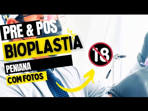 Leonardo De Souza Alves-117