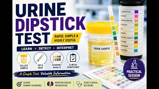 Urine Dipstick Test