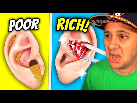 From POOR To RICH In Earwax Clinic