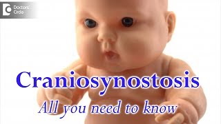 Craniosynostosis - All you need to know - Dr. Derick Mendonca
