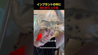 インプラントの中にカビが入ってる