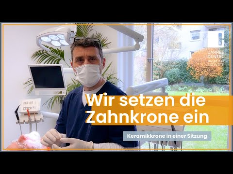 Zahnkrone einsetzen Ablauf: Krone in einer Sitzung mit CEREC | Carree Dental Köln