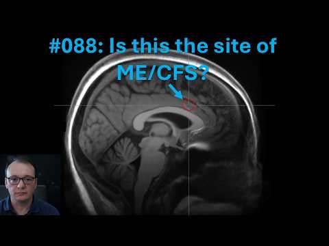 Cfs Defined For Escort Industry Newbies