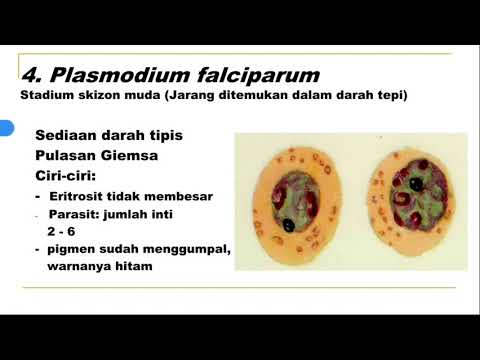 Plasmodium malária fejlődési ciklus röviden)