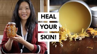 How to Use Calendula to Heal Skin  (3 Different Ways!)
