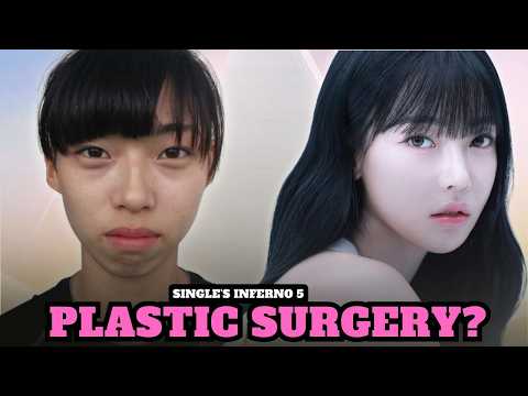 Kim Min Ji: Plastic Surgery Exposed & The Truth Behind Her Boss Moves | Single's Inferno 5