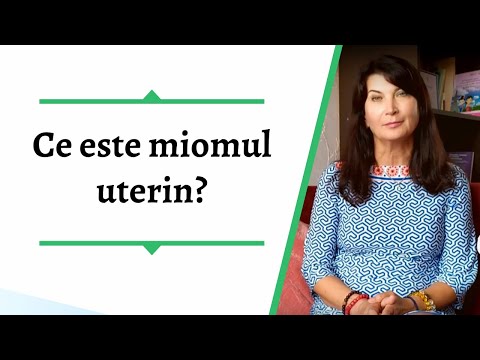 Ce este miomul uterin? Rodica Comendant