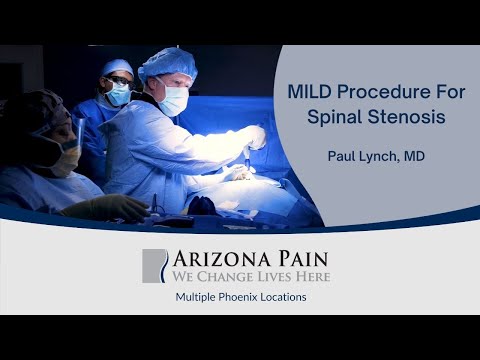 Watch A MILD Procedure For Spinal Stenosis | Arizona Pain