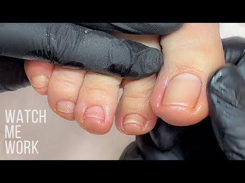 Wellness Pedicure: Detailing deep side walls, gentle dry pedi technique [Watch Me Work]